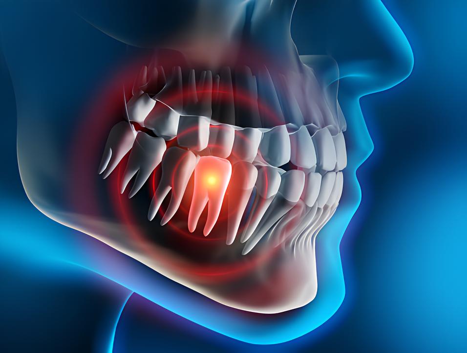 Teeth image - Emergency dentist Barnsley